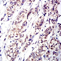 19 - Anti-CD114 Antibody AP95785