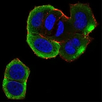 3 - Anti-CK2 beta Antibody AP95786