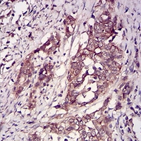 19 - Anti-CK2 beta Antibody AP95786