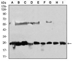 1 - Anti-CK2 beta Antibody AP95786