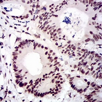 19 - Anti-CTNNBL1 Antibody AP95788