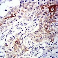 19 - Anti-CD183 Antibody AP95789