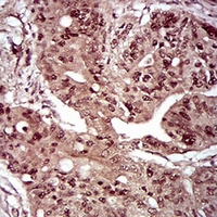 19 - Anti-DAP Kinase 3 Antibody AP95792