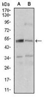 1 - Anti-DAP Kinase 3 Antibody AP95792