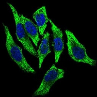 3 - Anti-DCTN4 Antibody AP95793