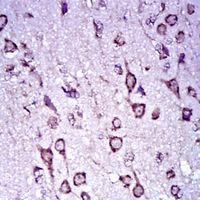 19 - Anti-Doublecortin Antibody AP95794