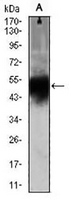 1 - Anti-Doublecortin Antibody AP95794