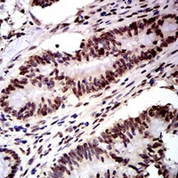 19 - Anti-DDX1 Antibody AP95795