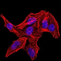 3 - Anti-DDX3X Antibody AP95797