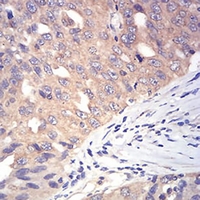 19 - Anti-DDX3X Antibody AP95797