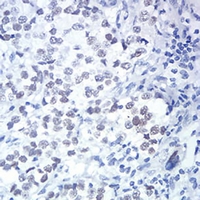 19 - Anti-DDX5 Antibody AP95798