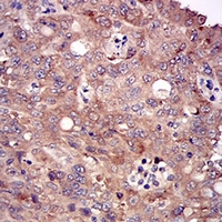 19 - Anti-DIS3L2 Antibody AP95799