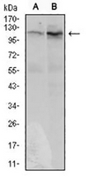 1 - Anti-DIS3L2 Antibody AP95799