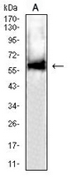 1 - Anti-DLL3 Antibody AP95801