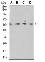 1 - Anti-TdT Antibody AP95803