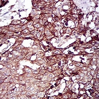 19 - Anti-Desmoglein 3 Antibody AP95804