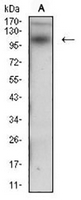 1 - Anti-Desmoglein 3 Antibody AP95804