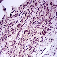 19 - Anti-E2F1 Antibody AP95805