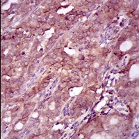 19 - Anti-EGFR Antibody AP95806