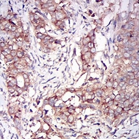19 - Anti-PKR Antibody AP95809