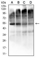 1 - Anti-EIF2B3 Antibody AP95810