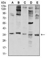 1 - Anti-Neutrophil Elastase Antibody AP95812
