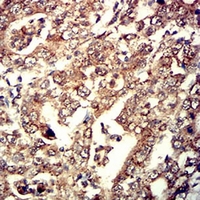 19 - Anti-Neutrophil Elastase Antibody AP95813