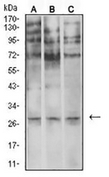 1 - Anti-Neutrophil Elastase Antibody AP95813