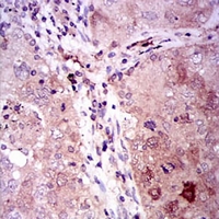 19 - Anti-Gamma-enolase Antibody AP95815