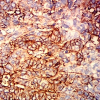 19 - Anti-CD326 Antibody AP95816