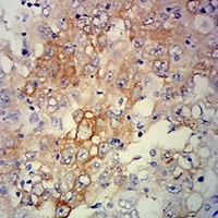 19 - Anti-ERCC1 Antibody AP95817