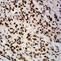 19 - Anti-Estrogen Receptor alpha Antibody AP95819