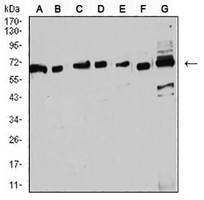1 - Anti-Estrogen Receptor alpha Antibody AP95819