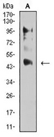 1 - Anti-ERR alpha Antibody AP95820