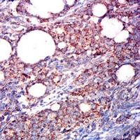 19 - Anti-ETFA Antibody AP95822
