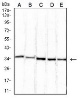 1 - Anti-ETFA Antibody AP95822