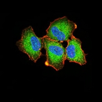 3 - Anti-Ezrin Antibody AP95825