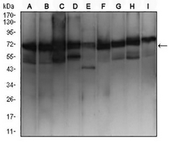 1 - Anti-Ezrin Antibody AP95825