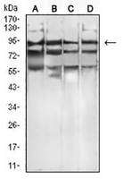 1 - Anti-FGFR4 Antibody AP95828