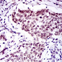 19 - Anti-FOXP1 Antibody AP95830