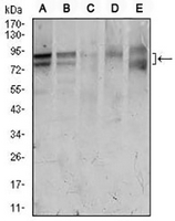 1 - Anti-FOXP1 Antibody AP95830