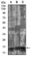 1 - Anti-FSH beta Antibody AP95832