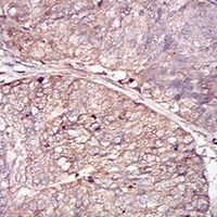 19 - Anti-Ferritin L Antibody AP95833