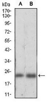 1 - Anti-Ferritin L Antibody AP95833