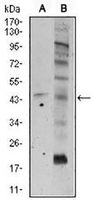 1 - Anti-Frizzled 5 Antibody AP95834