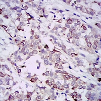 19 - Anti-GAB1 Antibody AP95835