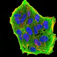 3 - Anti-GFAT Antibody AP95837