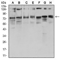 1 - Anti-GFAT Antibody AP95837