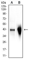 1 - Anti-Glutamine Synthetase Antibody AP95838
