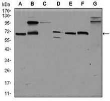 1 - Anti-Glypican 3 Antibody AP95843